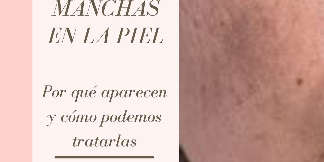 manchas en la piel por el sol