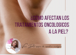 como afectan los tratamientos oncológicos a la piel